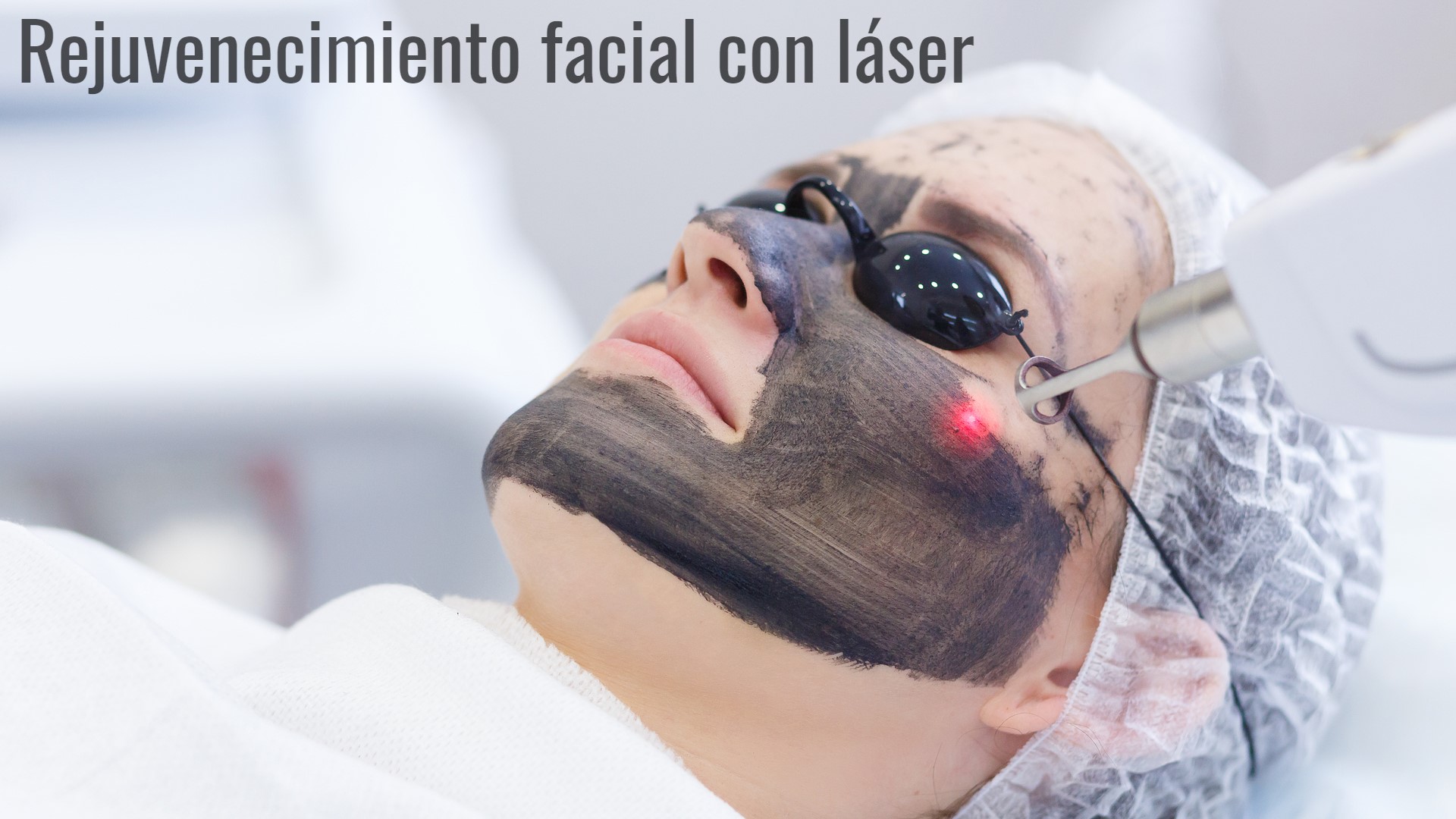 tratamiento peeling facial